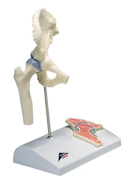 3B Scientific Anatomical Model - mini hip joint with cross section of bone on base - Includes 3B Smart Anatomy